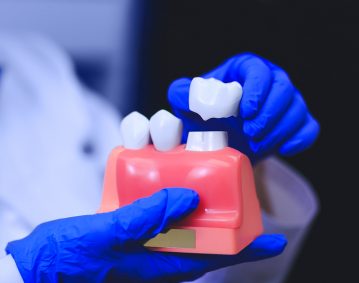 Couronne dentaires-Clinique dentaire Famili-Dent à Granby, Plessisville et Sorel-Tracy