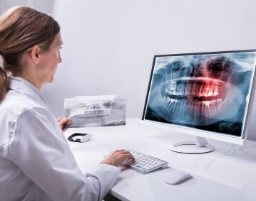 Radiographie numérique-Clinique dentaire Famili-Dent à Granby, Plessisville et Sorel-Tracy